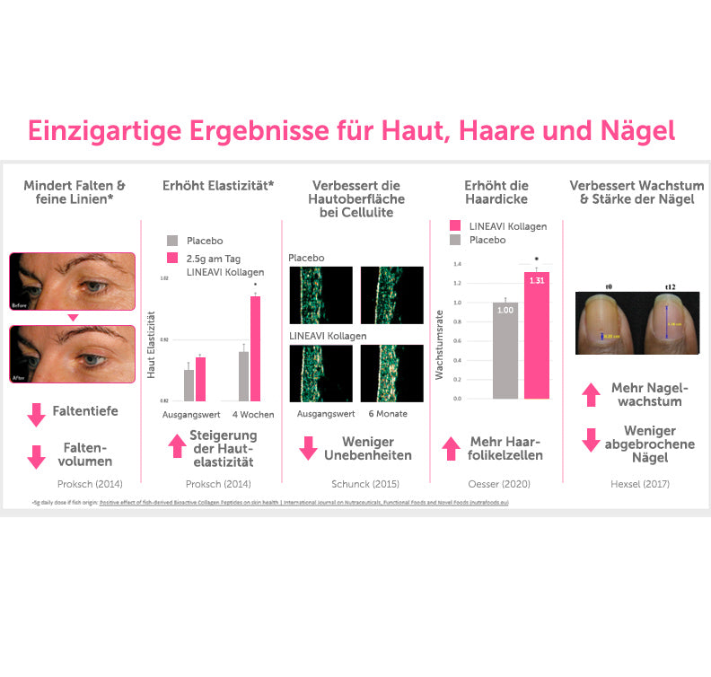 #locale_de#locale_nl